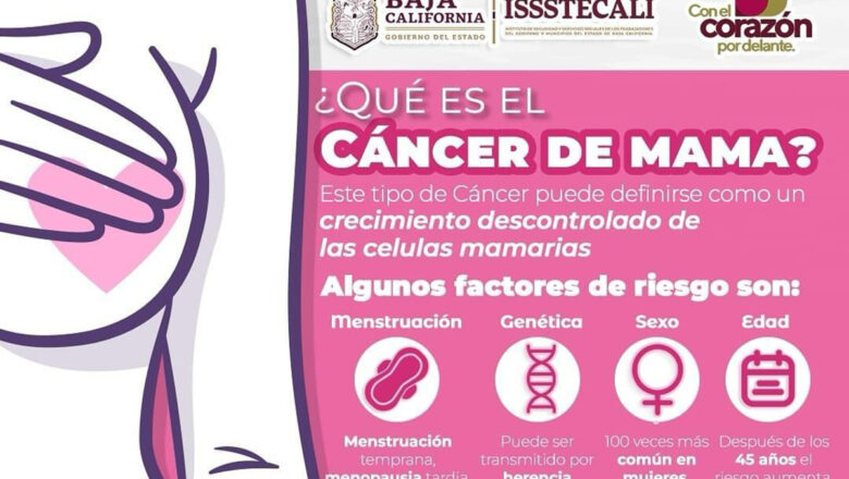 Invita Issstecali a mujeres y varones a realizarse la mamografía